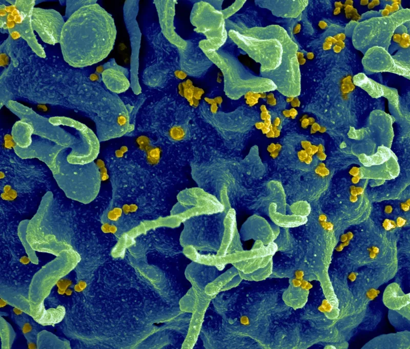 Virus in detail
